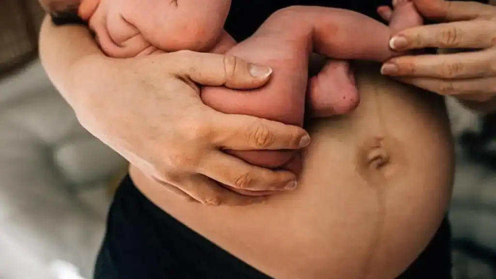 Why Is My Stomach Still Big After Pregnancy Oxford?